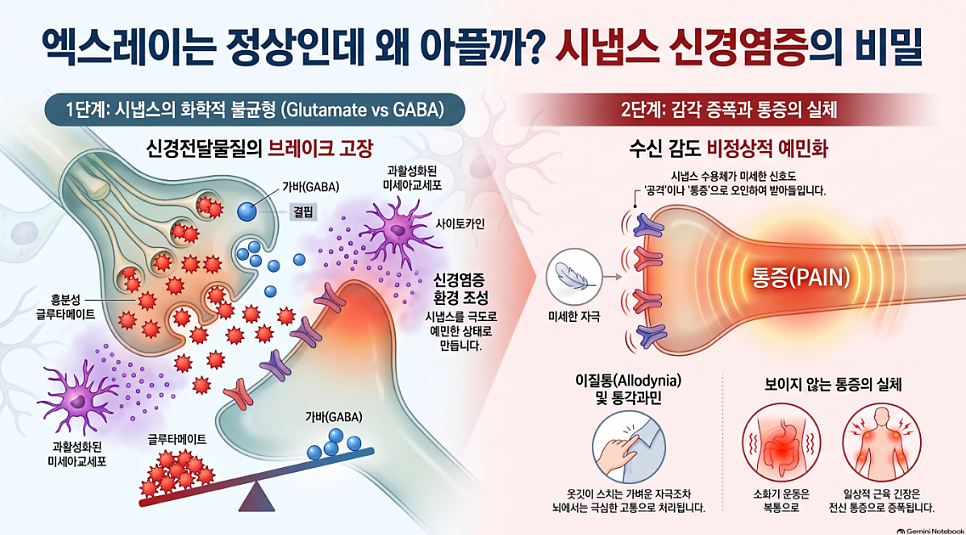 만성 피로와 잦은 배탈, 꾀병이 아닌 뇌신경계 과흥분 신호인 이유
